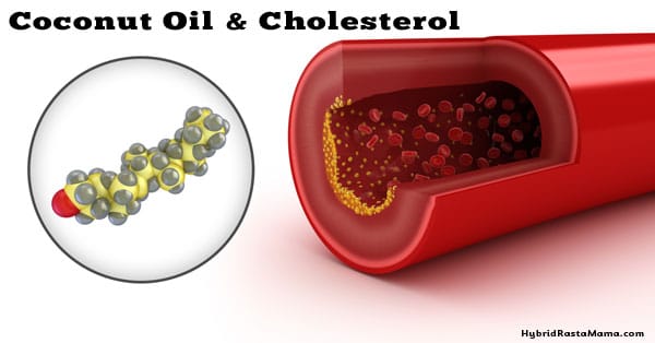 Coconut Oil and Cholesterol