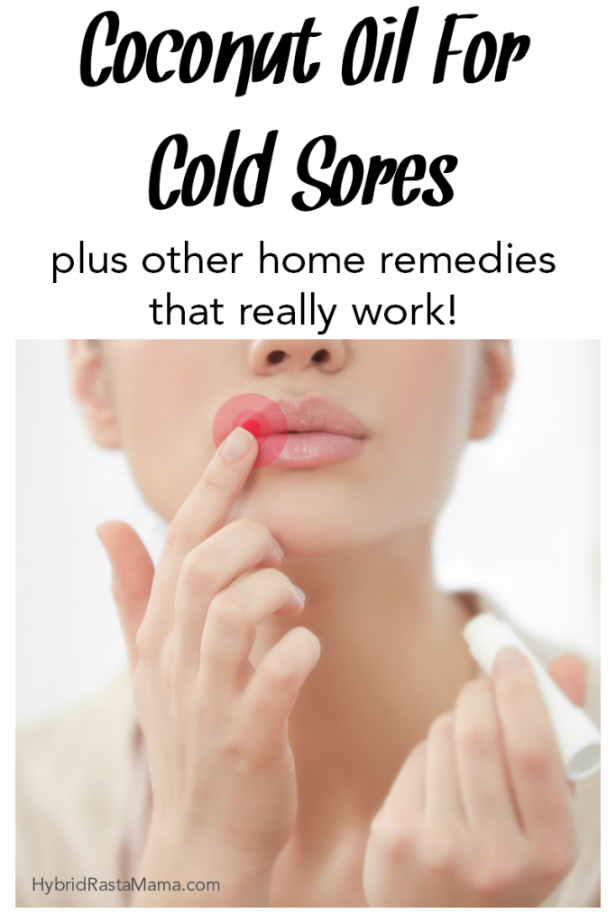 Coconut Oil For Cold Sores + Other Home Remedies Hybrid Rasta Mama