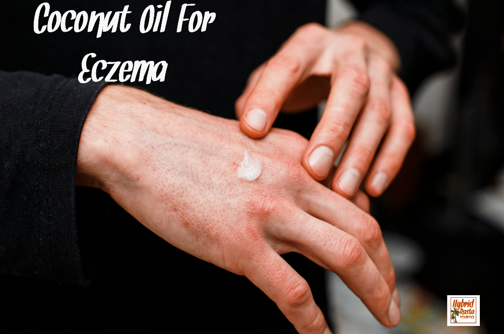 A man applying coconut oil to his eczema on his hand