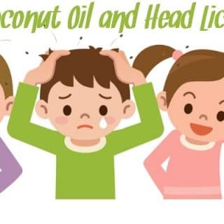 Three children with head lice using coconut oil to get rid of lice and eggs