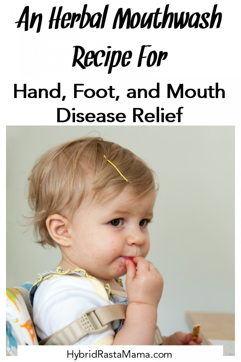 Hand, Foot, and Mouth Disease In Children + An Herbal Mouthwash Recipe