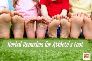 Bottoms of children's feet who have been using herbal remedies for athlete's foot
