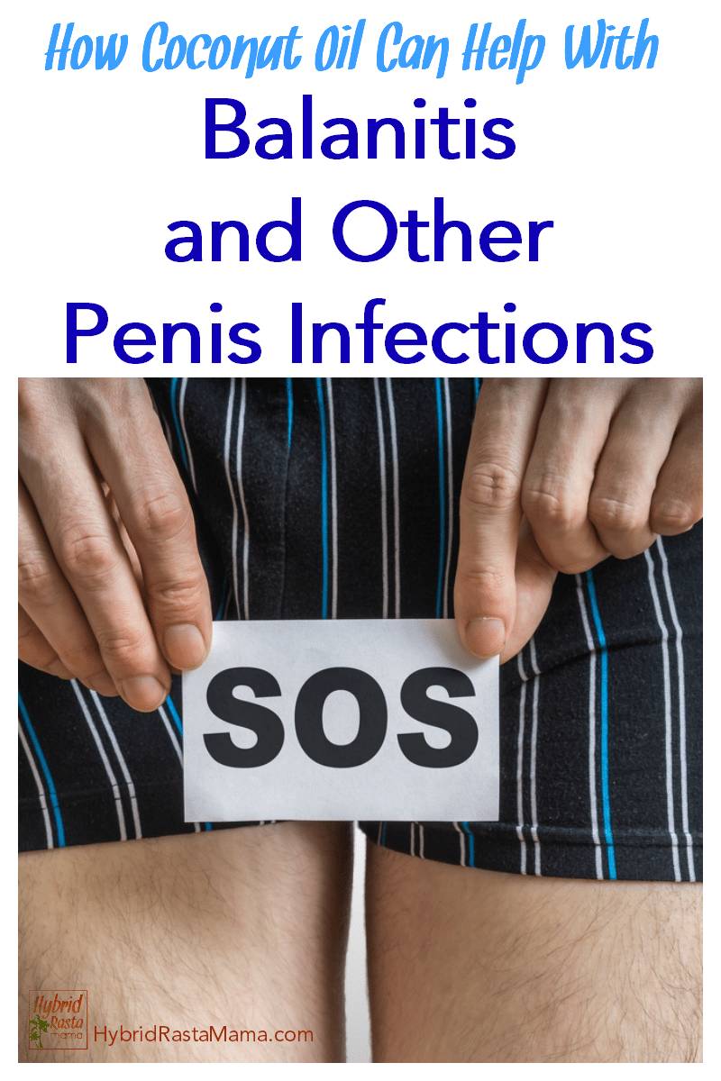 A man in boxer shorts with balanitis holding an SOS sign in front of him.