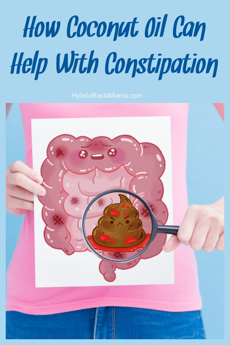 A woman holding an illustrated xray of her intestines with a poop emoji depicting constipation