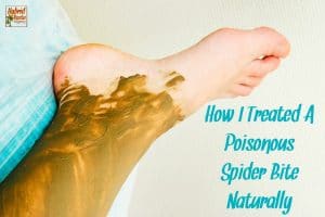 A spider bite can be a scary thing and often times warrants a trip to a medical professional. However, lots of spider bites can be treated naturally with affordable toxin removing remedies. Learn how I treated a poisonous spider bite naturally.