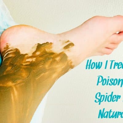 How To Treat A Spider Bite At Home