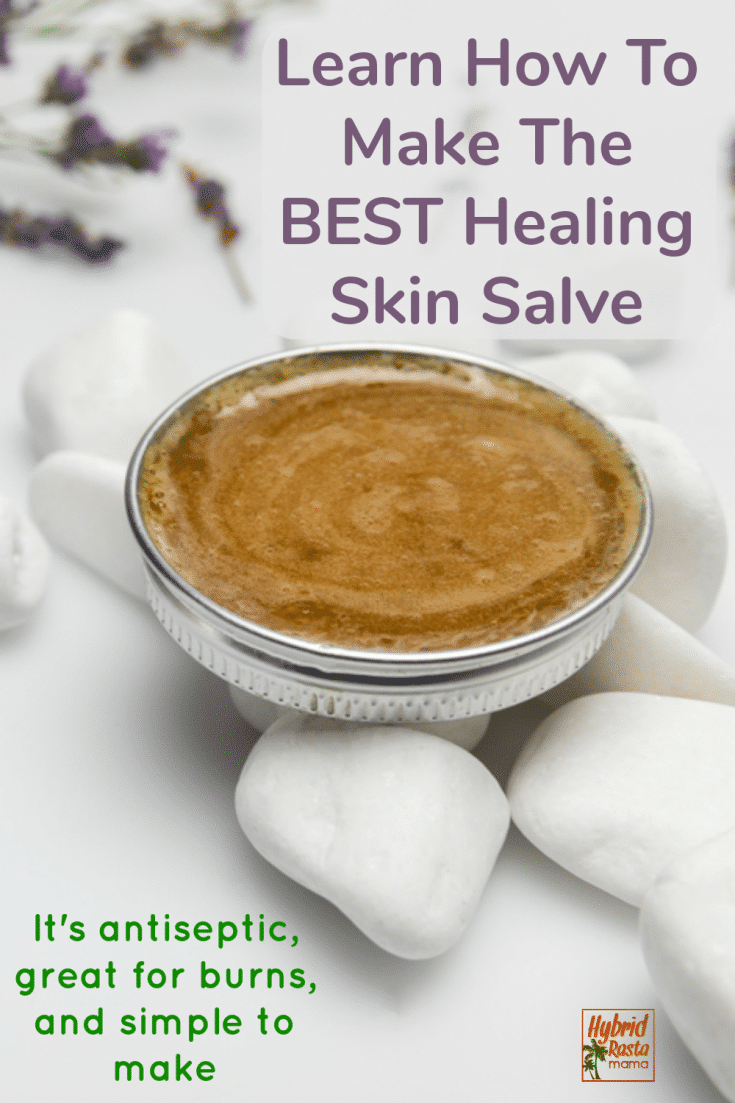 Lavender Oil For Burns + A DIY Burn Salve Hybrid Rasta Mama