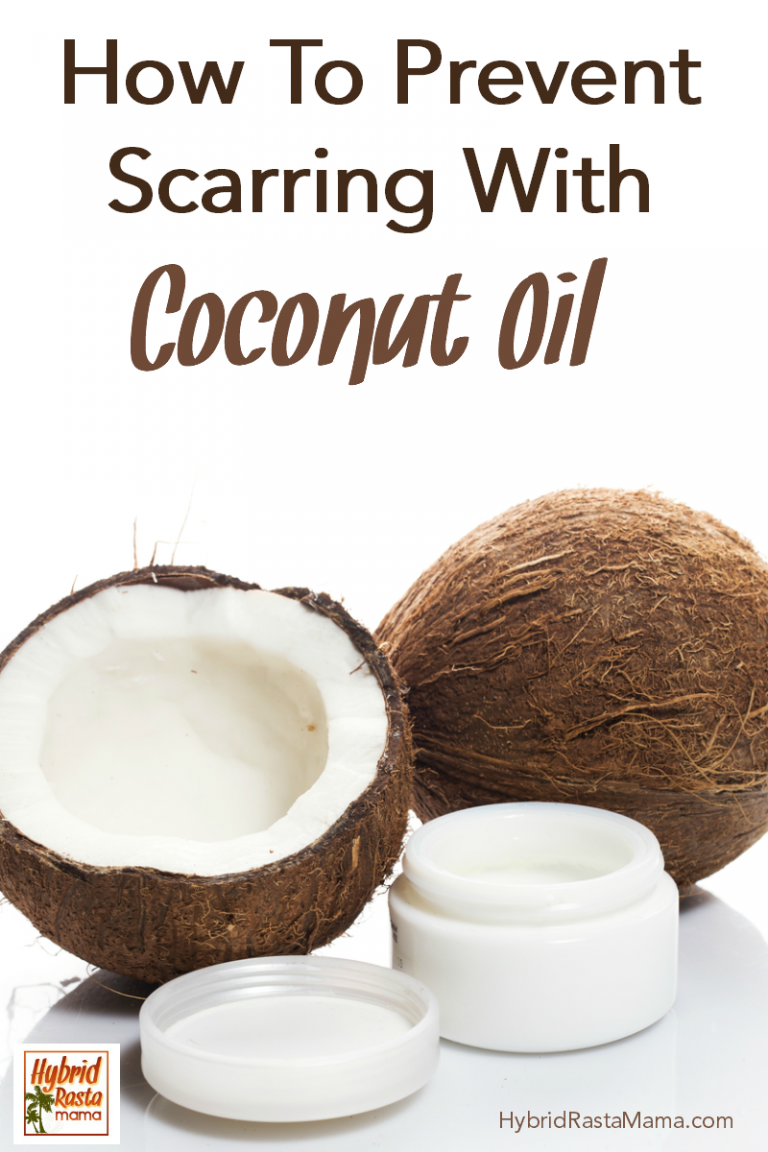 How To Prevent Scarring With Coconut Oil Hybrid Rasta Mama