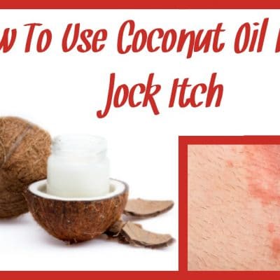 How To Use Coconut Oil For Jock Itch