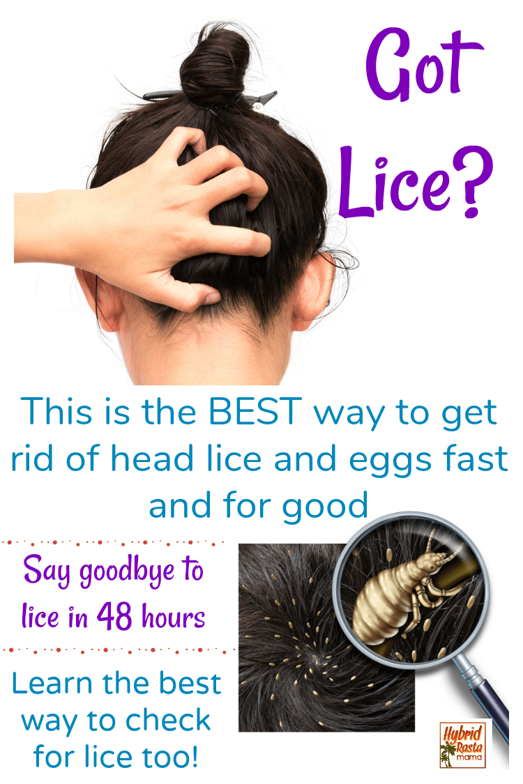 A woman with head lice scratching the back of her head. Head lice under a microscope as someone checks for lice. Part of the best lice treatment plan.