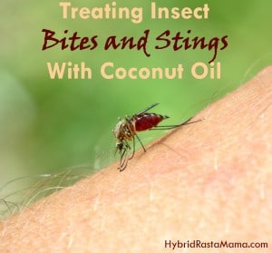 Bug bites and stings got you down? No worries...coconut oil to the rescue! Learn how coconut oil can help with all kinds of bug bites and stings in this post from HybridRastaMama.com.