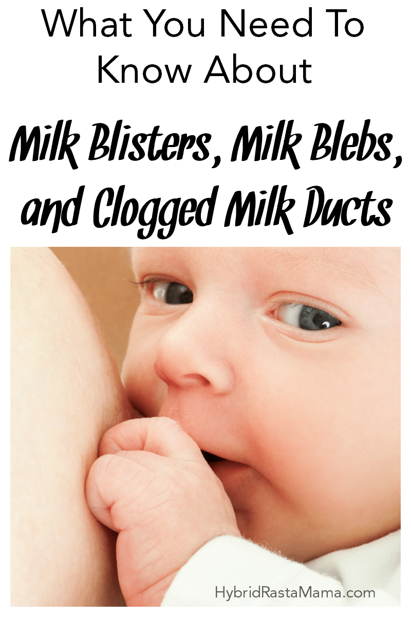 A baby breastfeeding with an impish look on his face. His mother has a milk blister